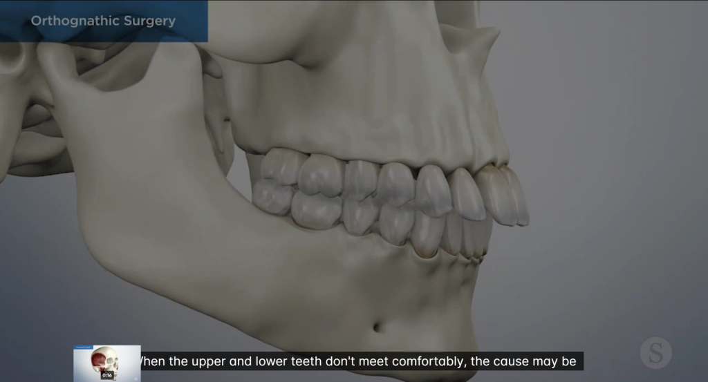 An Introduction to Orthognathic Surgery
